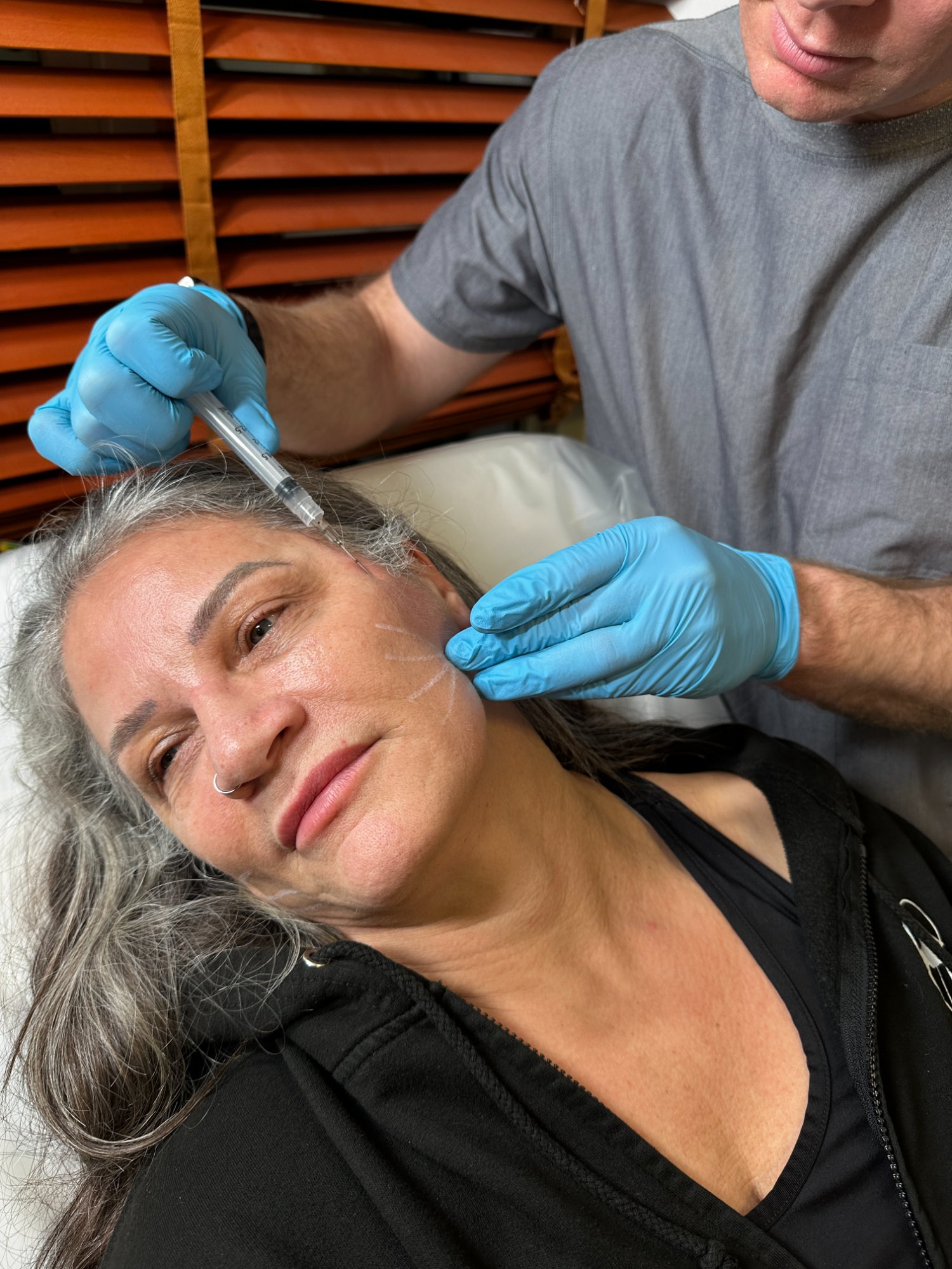 Facial injectable treatment