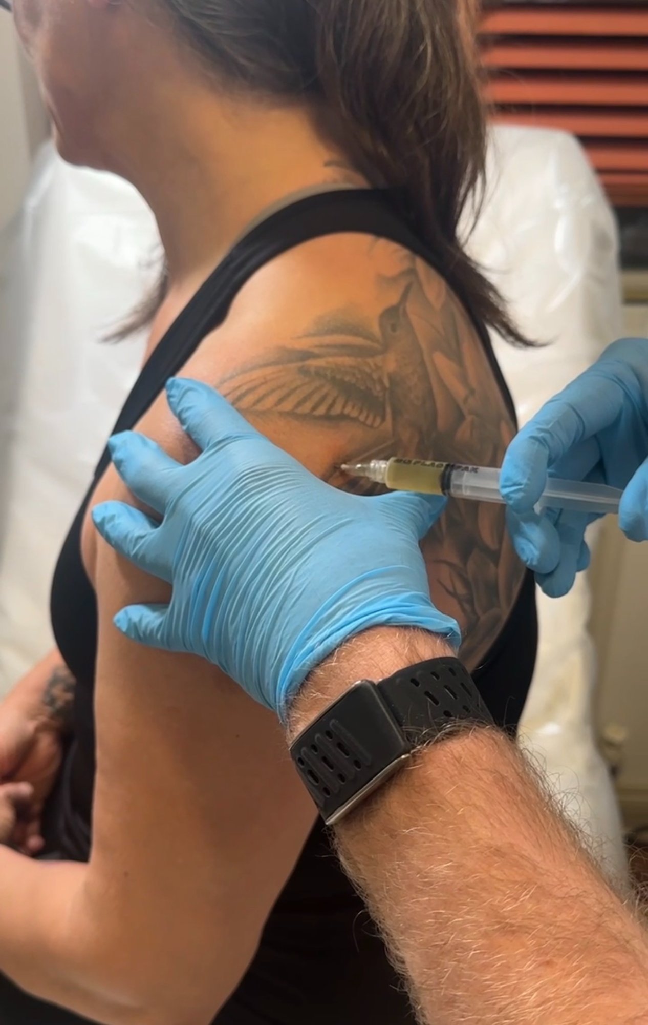 PRP joint injection at JW Aesthetics